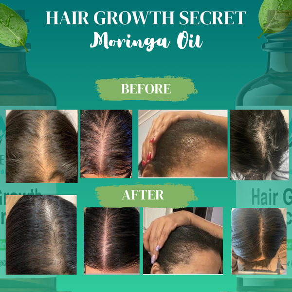 Hair Growth Secrets (Moringa Hair Oil)